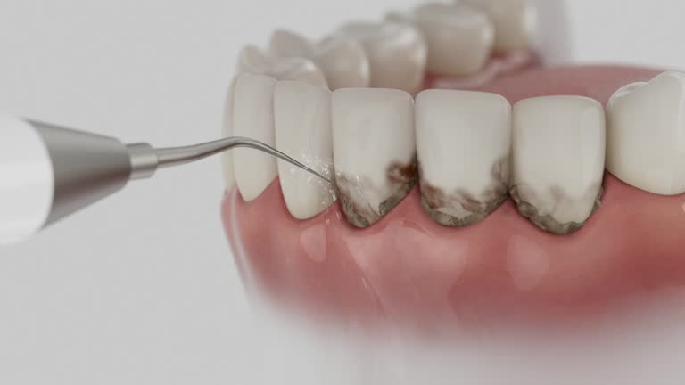 Trusted Teeth Whitening service in Reading, MI - Dentist Open Now
